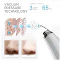 6 in 1 Blackhead Remover β USB Rechargeable Pore & Acne Cleaner